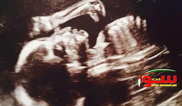 مصري أقنع “جميلة” بممارسة الجنس لإخراج الجن من رحمها !! | موقع سوا مصري أقنع “جميلة” بممارسة الجنس لإخراج الجن من رحمها !! | موقع سوا