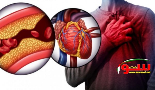 ضغوط وتوجهات من أجل إدراج علاج ضغوط وتوجهات من أجل إدراج علاج