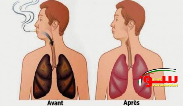  لمدخني السيكارة والأركيلة.. هذه الأطعمة تنظف رئتيكم من النيكوتين والقطران! | موقع سوا 