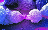 يقظة الخلايا تكافح السرطان | موقع سوا 