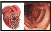 كيف تعرفون إذا كان لديكم طفيليات في الأمعاء  | موقع سوا 